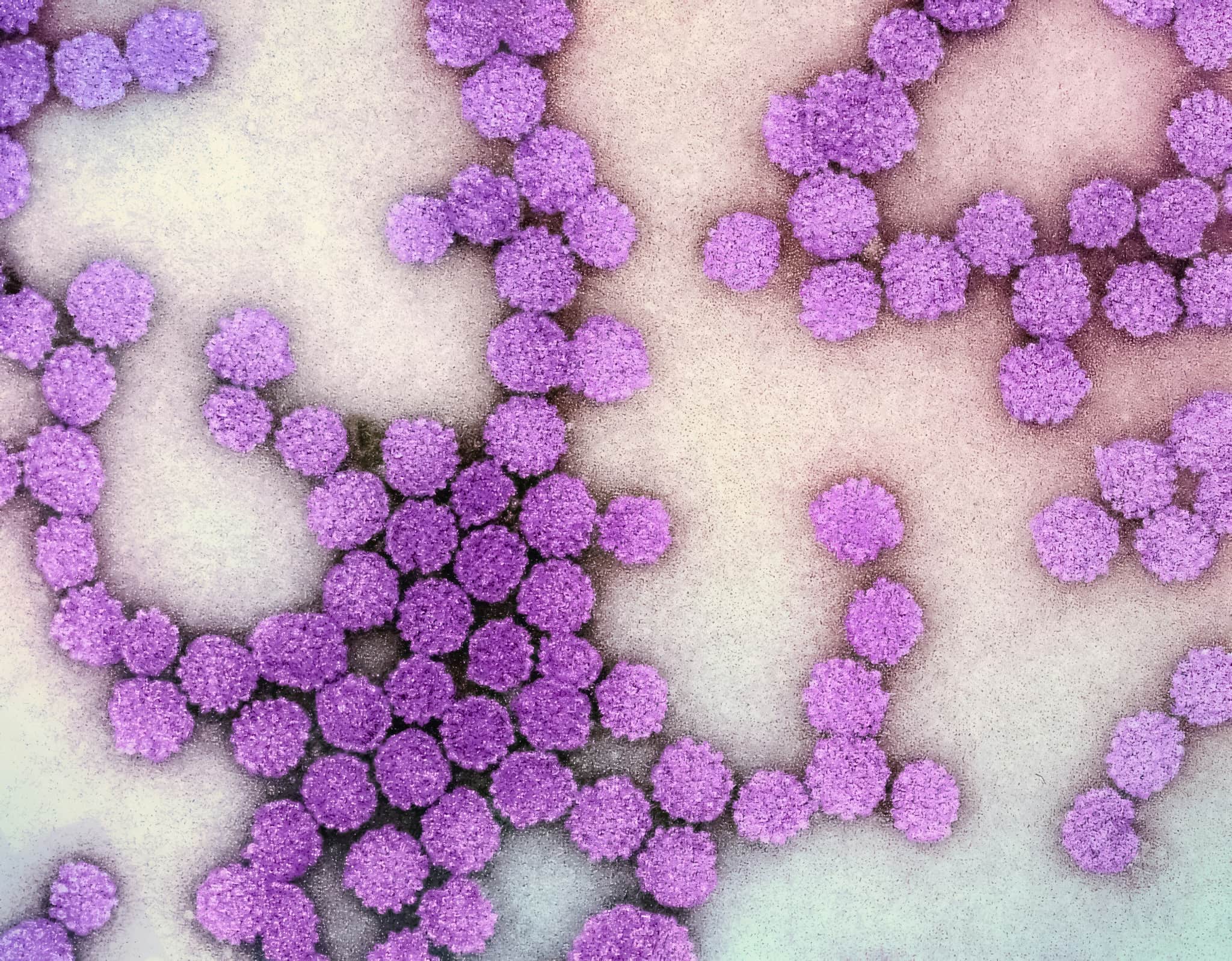 Transmission electron micrograph showing HPV and cancer particles.